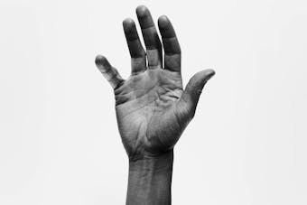 Dermatitis y ansiedad